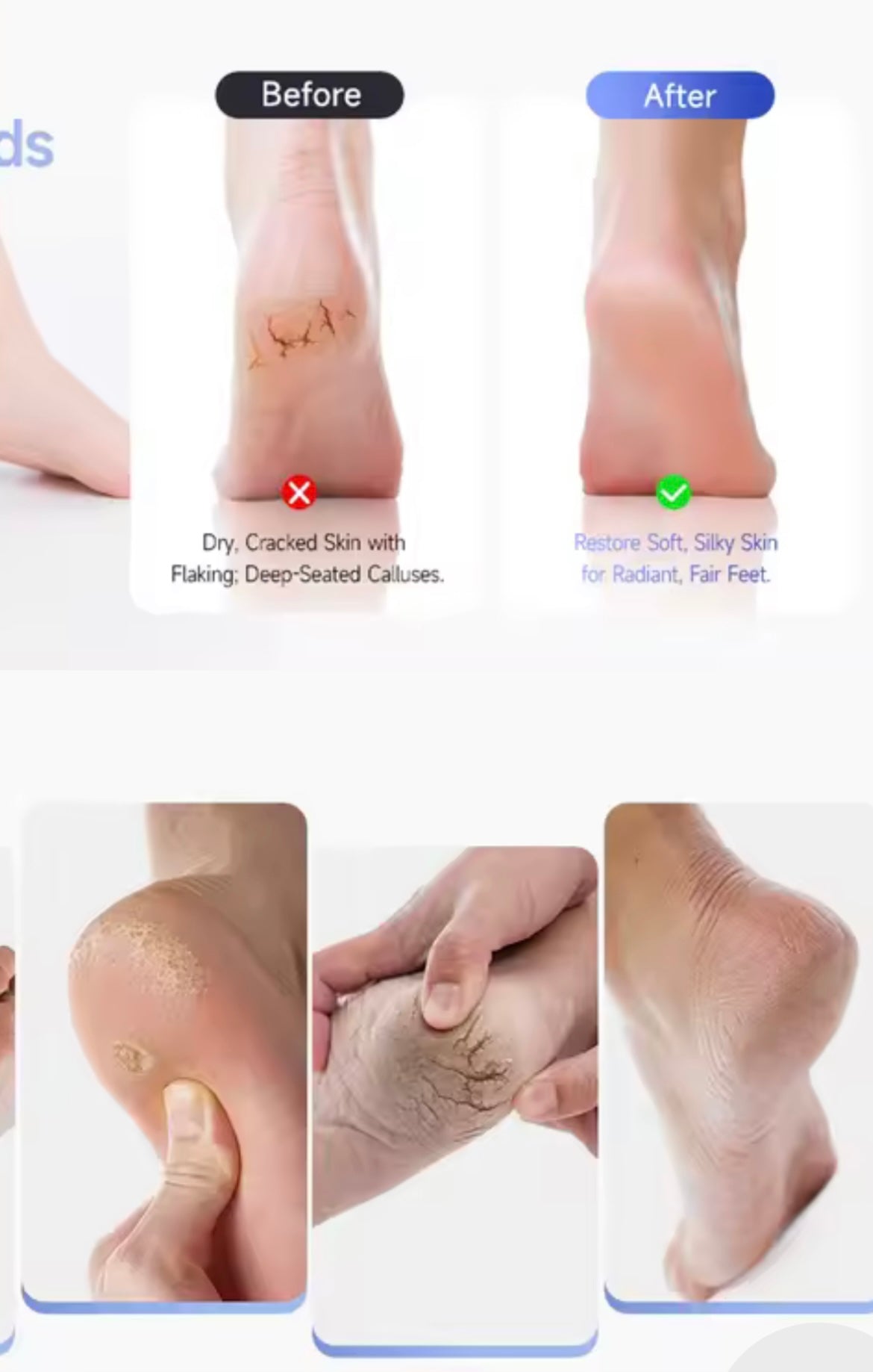 Râpe électrique _ anti-callosités _ Pieds Doux Instantanément | Portable | Rechargeable & Puissant